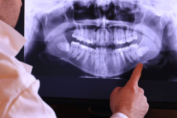 Best Emergency Root Canal Treatment in Long Valley, NJ