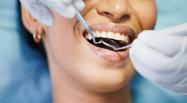 Best Emergency Wisdom Teeth Removal in Long Valley, NJ